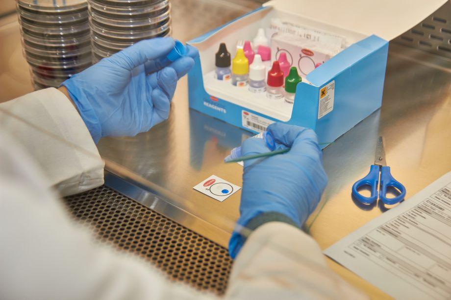 Les mostres d'aigua per a la detecció de legionel·la s'analitzen al laboratori 